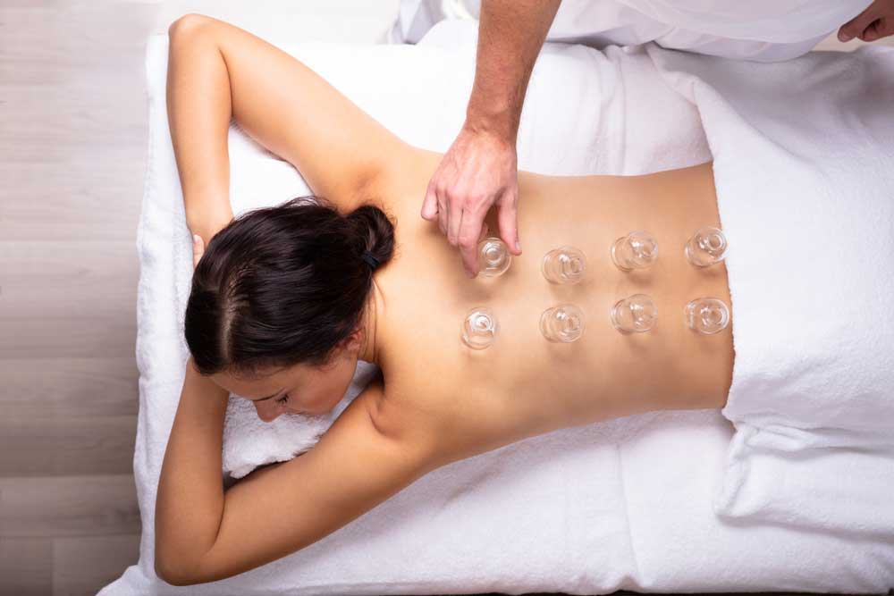 Cupping Therapy